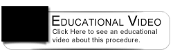Dental Education Video - How do I use Dental Floss?