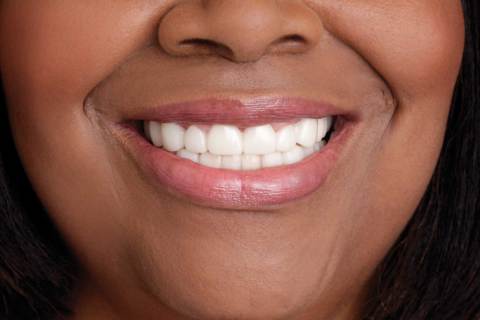 African American With Straight Teeth